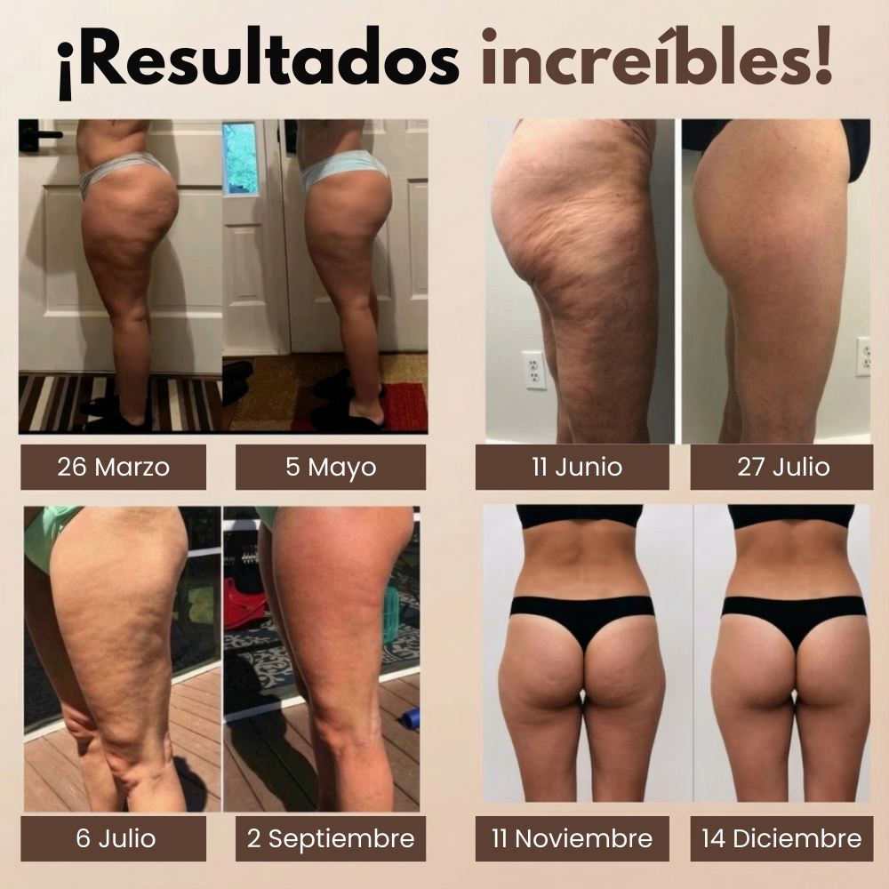 Leggings 3D Anticelulíticos