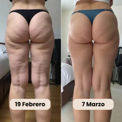 Leggings 3D Anticelulíticos